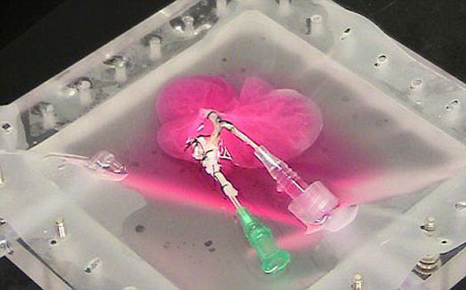 Szervkereskedelem - Élő donorokat verbuvált egy férfi Ukrajnában