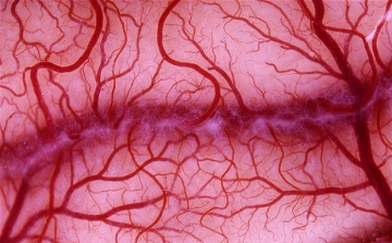 Őssejtből állítottak elő mesterséges vérereket amerikai orvosok