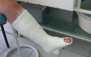 Vagyont kapott kártérítésként bokaficamért egy elítélt