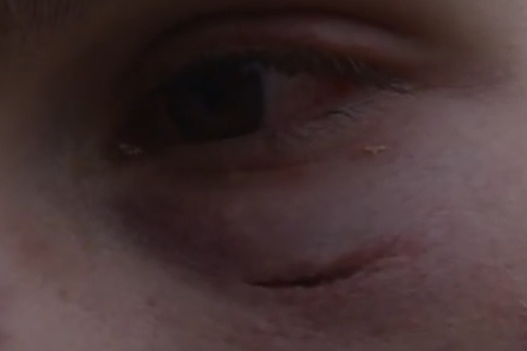 Magyar fiatalokra támadtak Szabadkán