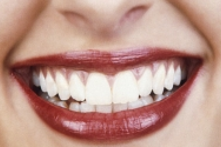 A szájban lévő baktériumok okozhatják a vastagbélrákot