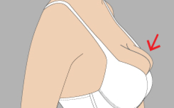 Milyen melltartót vegyek?