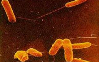 Kövérsége mentette meg egy férfi életét húsevő baktériumtól