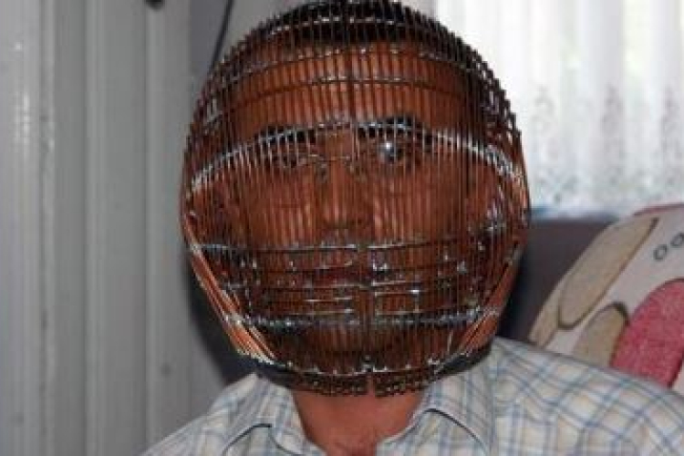 Ilyen se volt még! Ketreccel a fején próbál leszokni a cigiről