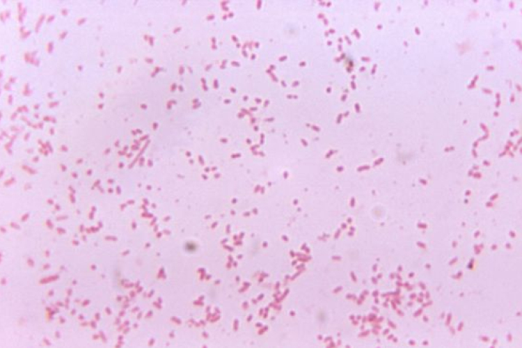 A baktériumok befolyásolják súlyunk alakulását 